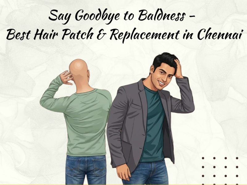 Best Hair Patch & Hair Replacement Treatment in Chennai | Non-Surgical Hair Solution