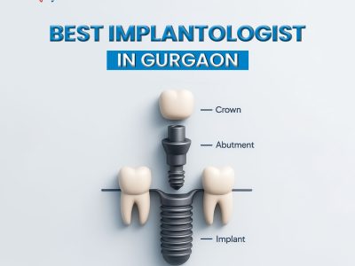 Best Implantologist in Gurgaon for Advanced Dental Implants