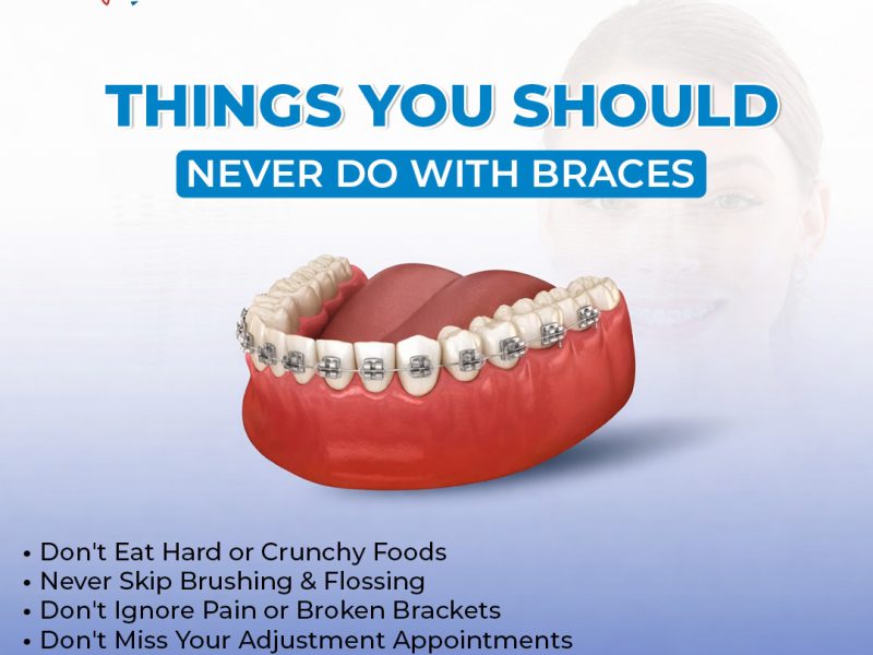 Best Braces Specialist Near Me for Expert Orthodontic Care