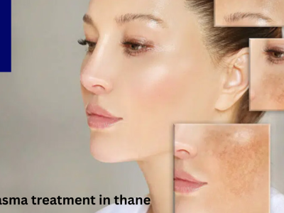 DNA Royal: Best Melasma Treatment in Thane for Clear, Even Skin.