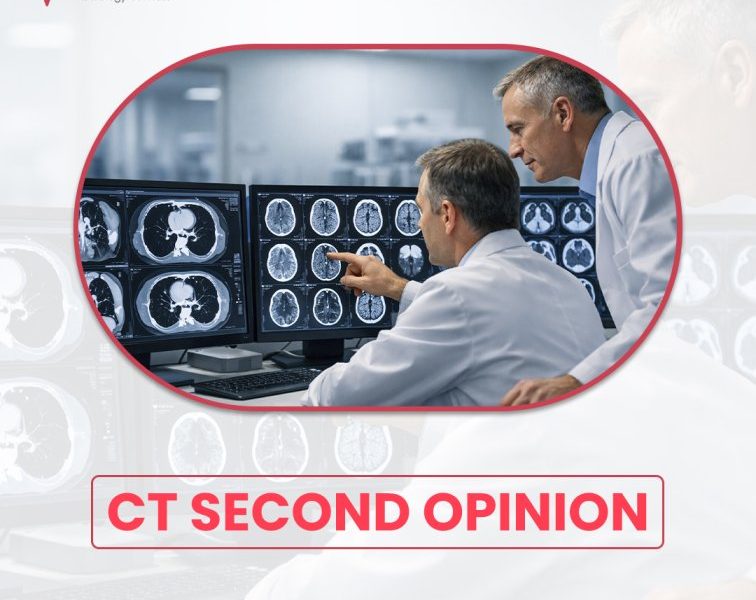 CT Second Opinion for Accurate Diagnosis