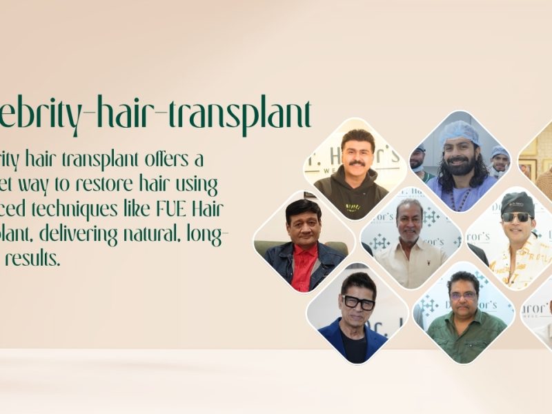 Celebrity Hair Transplant – Natural & Long-Lasting Hair Restoration
