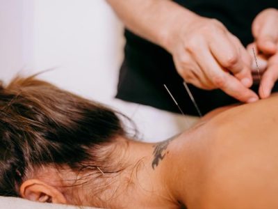 Dry Needling Therapy in Gurgaon – Effective Pain Relief & Muscle Recovery Treatment