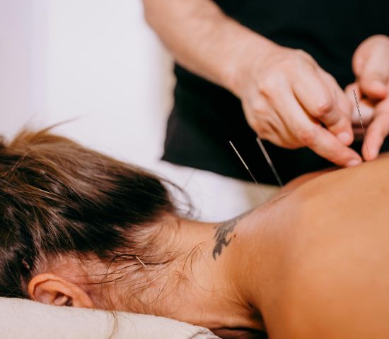 Dry Needling Therapy in Gurgaon – Effective Pain Relief & Muscle Recovery Treatment