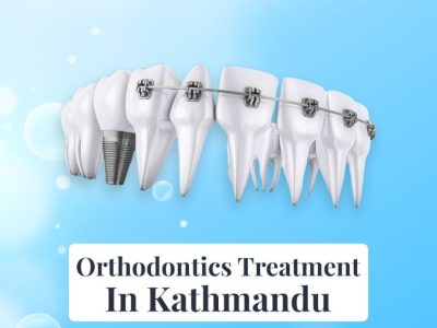 Best Orthodontics Treatment in Kathmandu