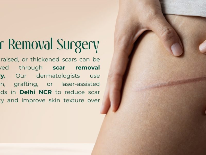 Scar Removal Surgery for Smoother & Clearer Skin