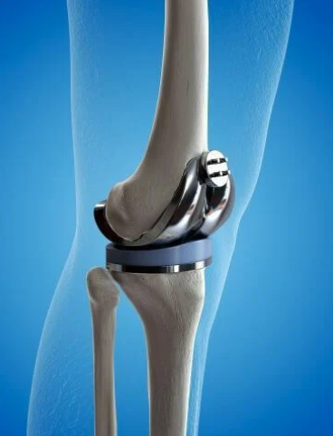 Best Orthopedic Hospital in kushaiguda