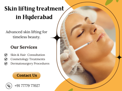 Skin Lifting Treatment In Hyderabad | Dr. Venus