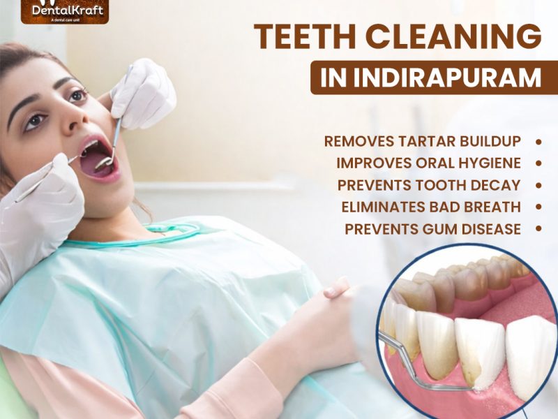 Teeth Cleaning in Indirapuram for a Healthy Smile