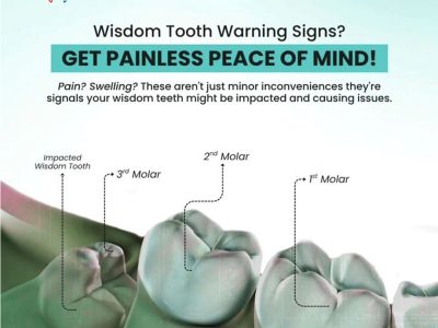 Wisdom Teeth Removal Near Me for Safe Surgical Treatment