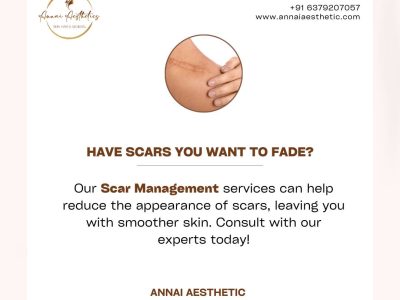 Annai Aesthetics: Erase the Past with the Best Dermatologist in Ekkaduthangal