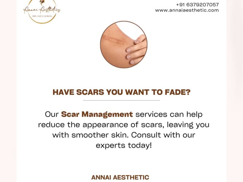 Annai Aesthetics: Erase the Past with the Best Dermatologist in Ekkaduthangal