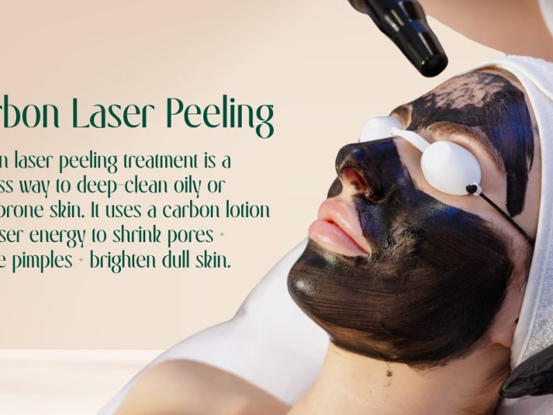 Carbon Laser Peel | Instant Glow & Acne Control