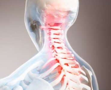 Advanced Cervical Spondylosis Treatment in Gurgaon