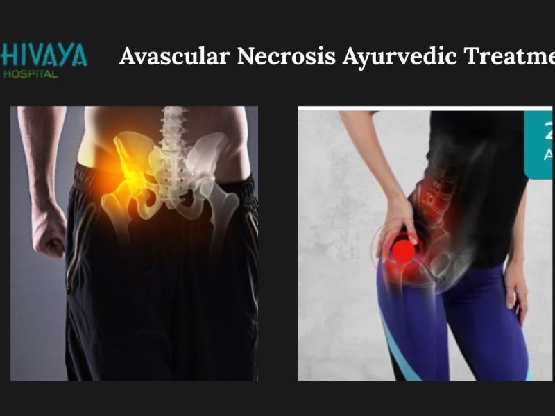 Avascular Necrosis Ayurvedic Treatment in India