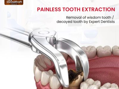 Best Dentist for Tooth Extraction in Indirapuram for Safe Care