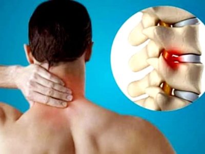 Get Lasting Relief with Advanced Spondylosis Treatment in Faridabad