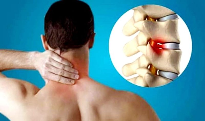 Get Lasting Relief with Advanced Spondylosis Treatment in Faridabad