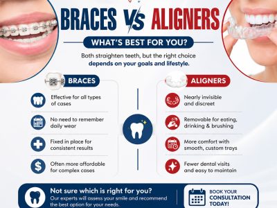 Clear braces near me for discreet teeth alignment