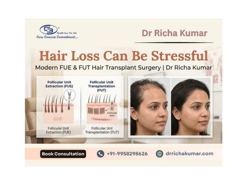 Hair Loss Can Be Stressful — Modern FUE & FUT Hair Transplant Surgery | Dr Richa Kumar
