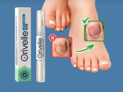 Orvelle Nail Pen: Safe, Effective, and Dermatologist-Approved Treatment