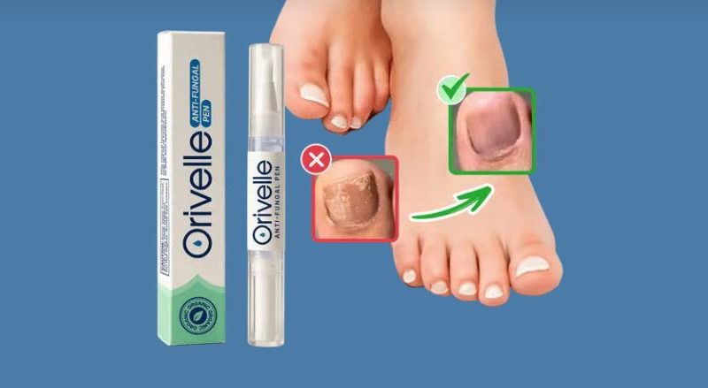 Orvelle Nail Pen: Safe, Effective, and Dermatologist-Approved Treatment