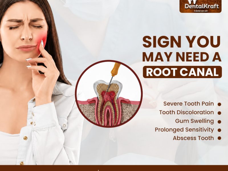 RCT Clinic in Indirapuram Offering Painless Root Canal Treatment