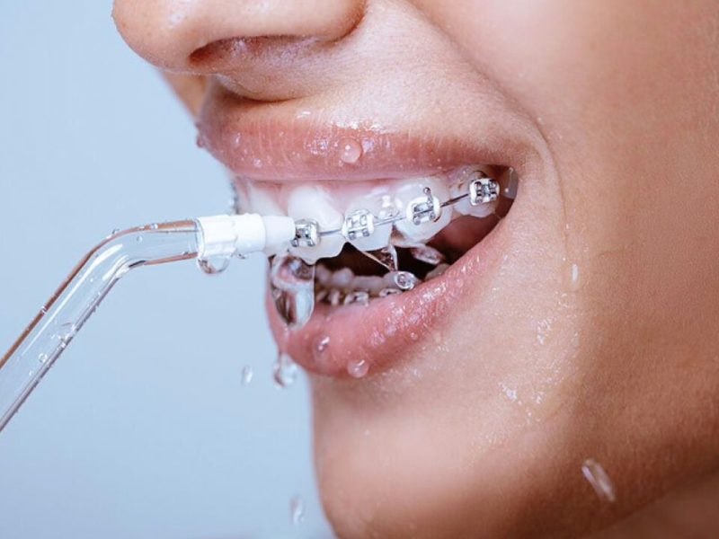 WellaWhite Water Flosser – Remove Plaque, Fresh Breath & Healthy Gums
