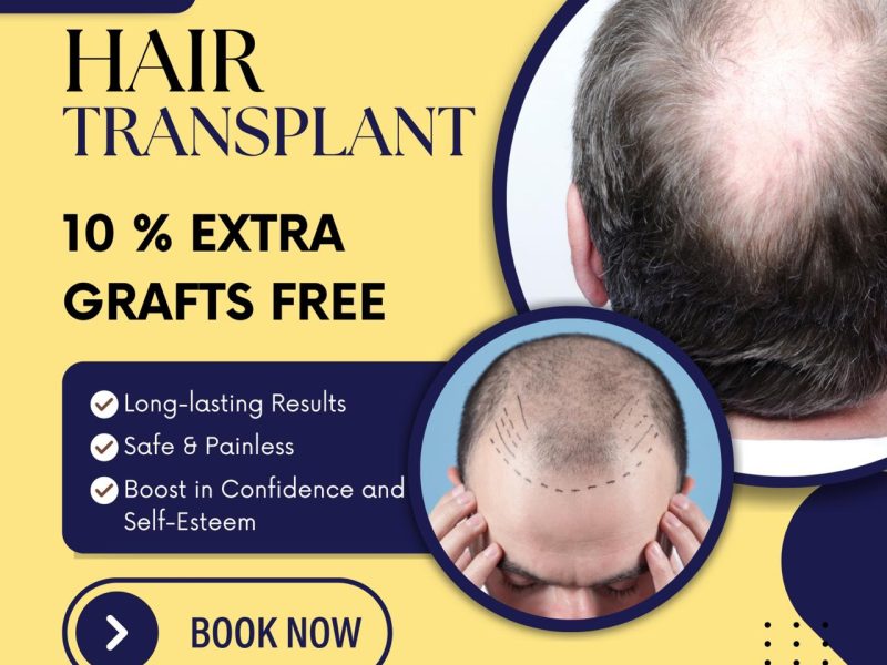 Top Rated No.1 Hair Transplant Clinic in Thane | DNA Royal.