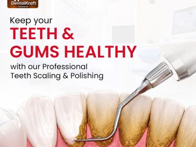 Teeth Whitening Treatment in Indirapuram for Brighter Smiles