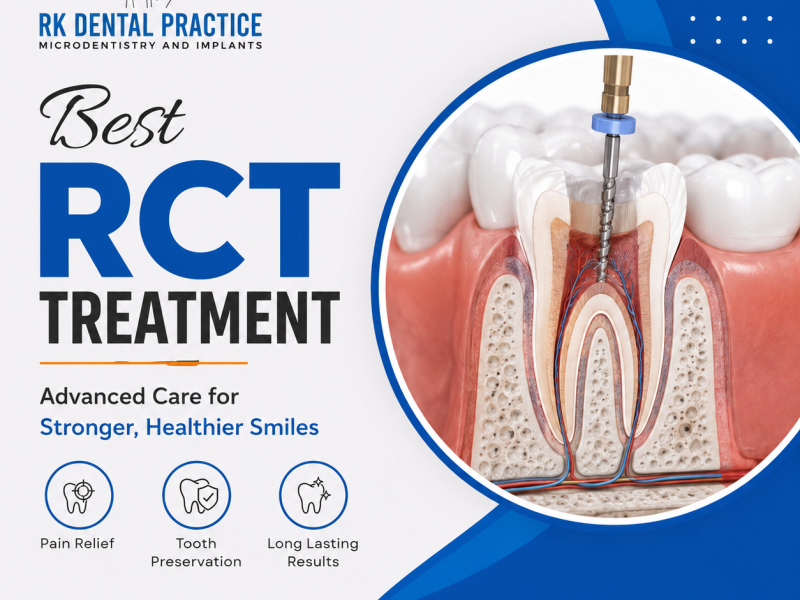 Best RCT Treatment Near You | RK Dental Practice