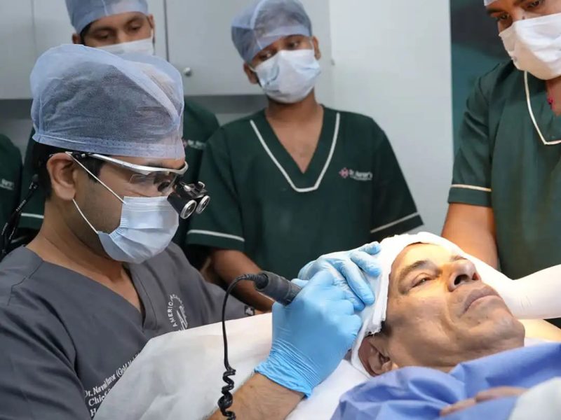 Modern Hair Transplant Techniques in Delhi for Permanent Hair Growth