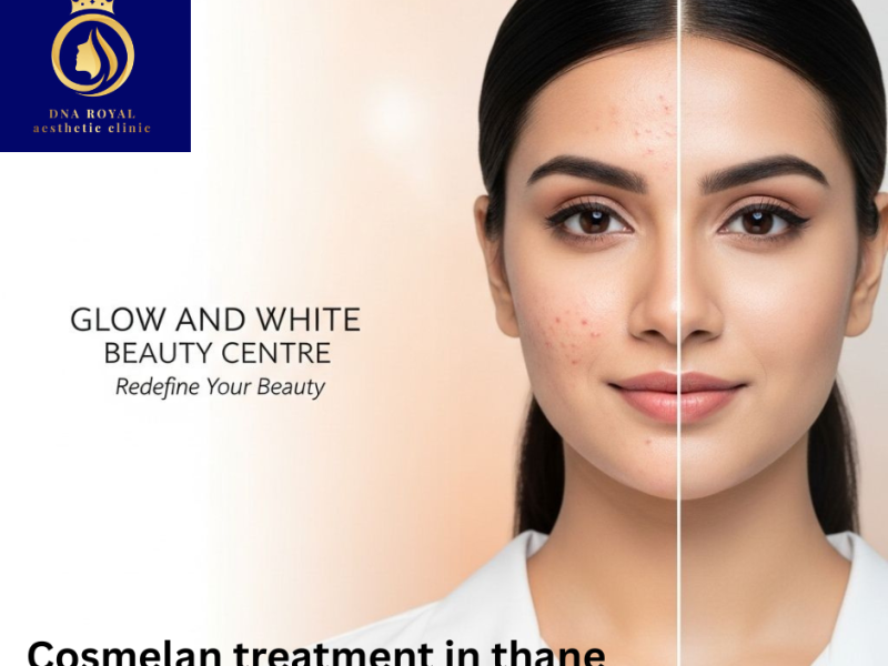 Get Flawless Skin with Cosmelan Treatment in Thane | DNA Royal.