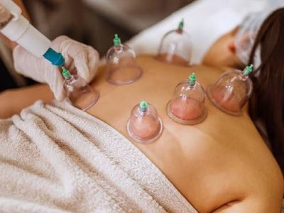 Cupping Therapy Services: Natural Pain Relief and Holistic Healing