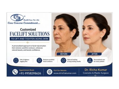 Customized Facelift Solutions to Lift and Tighten Aging Skin