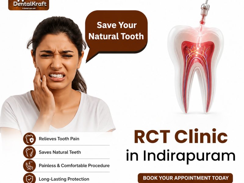 Trusted RCT Clinic in Indirapuram