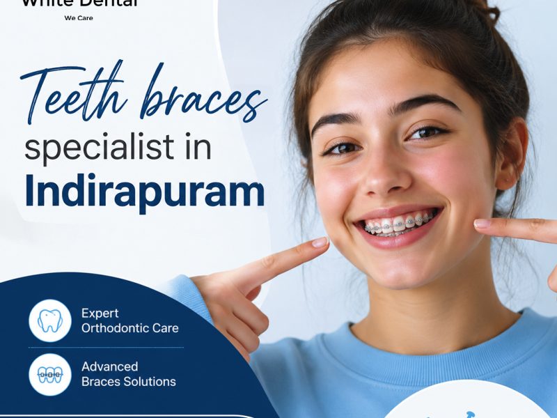 Teeth Braces Specialist in Indirapuram for Better Smile Alignment