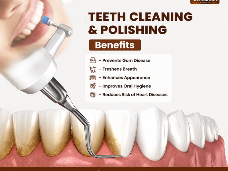 Teeth Cleaning in Indirapuram for Better Oral Health and a Brighter Smile