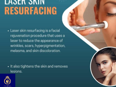 Affordable Laser Resurfacing Treatment in Thane | DNA Royal Experts.