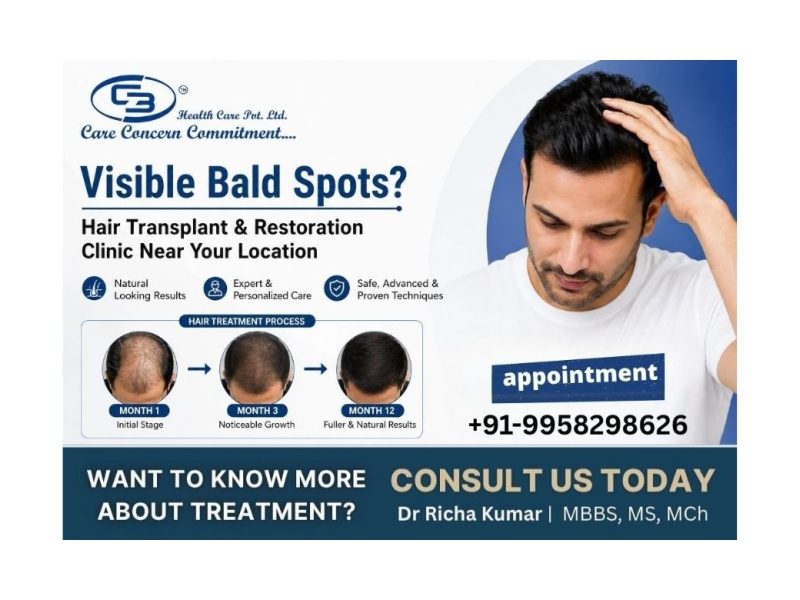 Visible Bald Spots? Hair Transplant & Restoration Clinic Near Your Location