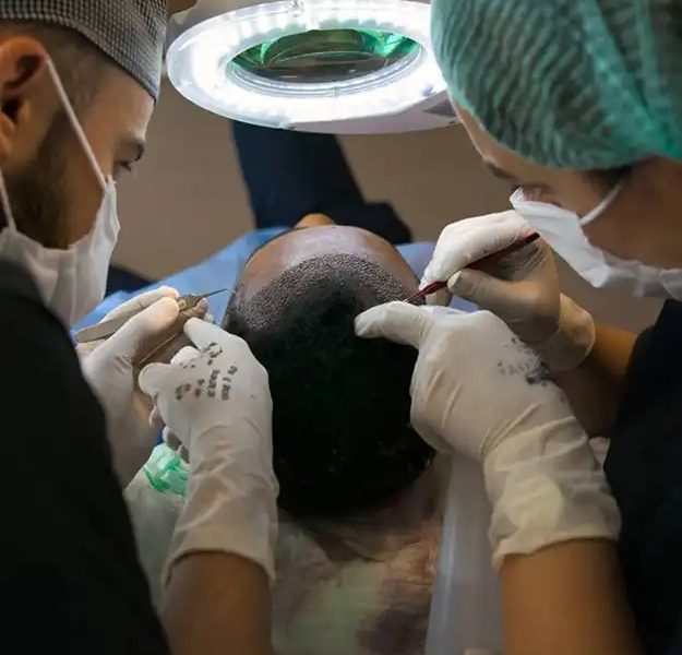 Specialized Afro Hair Transplant in Delhi for Curly & Coily Hair