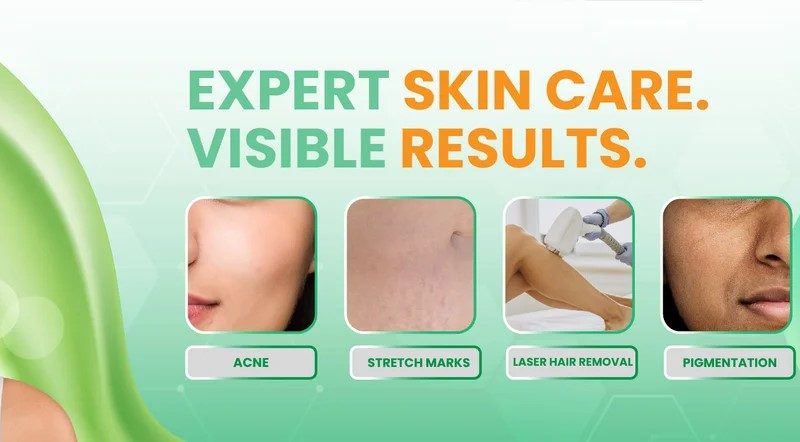 Keloid Laser Treatment – Advanced Solution for Scar Reduction