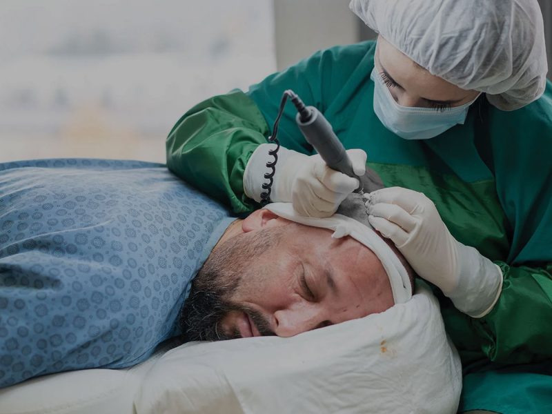 India's Gold Standard in Hair Transplantation