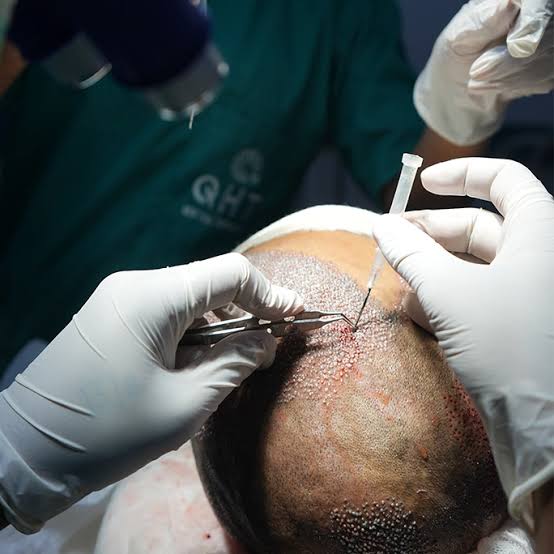 Trusted Hair Transplant Clinic in the UAE for Natural Results