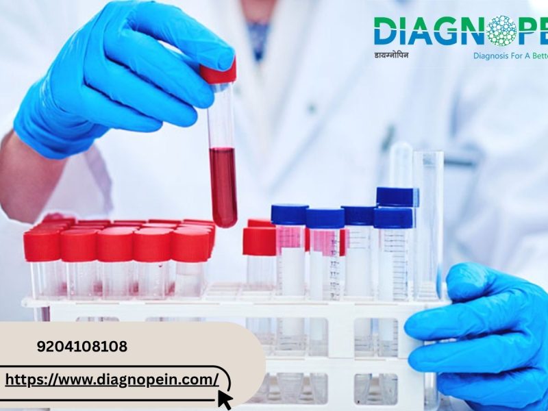 Best HbA1C Test in Pune | Monitor Diabetes with Expert Care