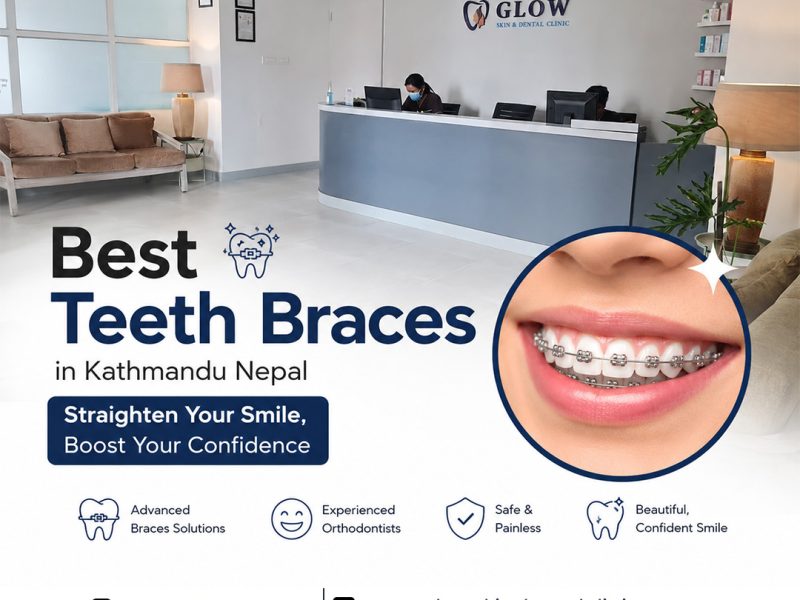 Best Teeth Braces in Kathmandu Nepal for Smiles