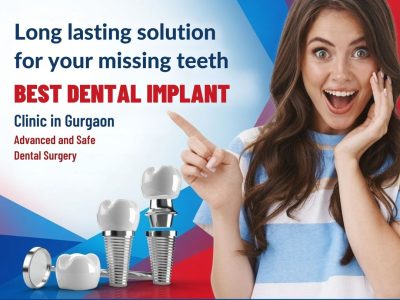 Best Dental Implant Clinic in Gurgaon for Permanent Solutions