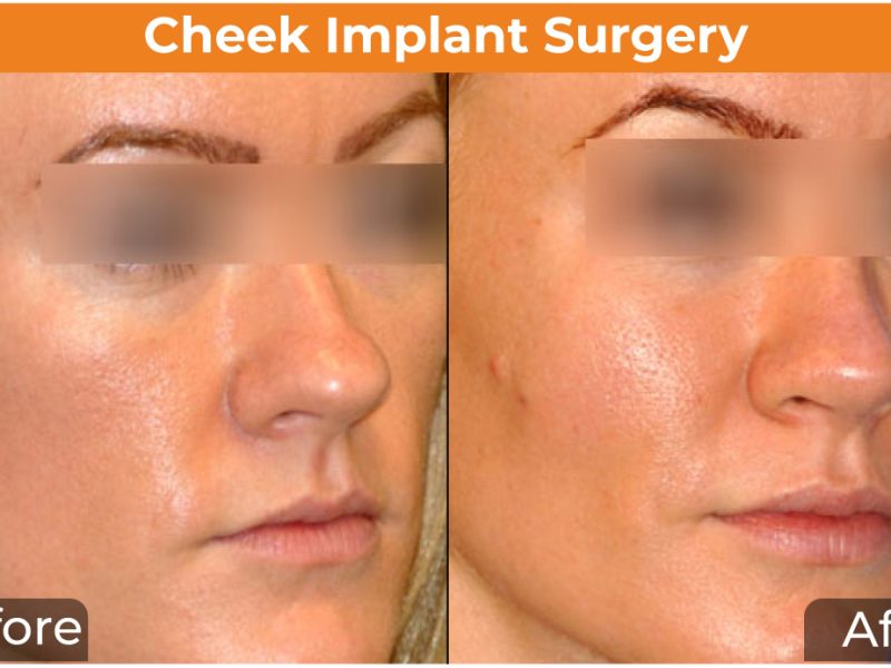 Best Anti-Aging & Face Wrinkle Treatment in Mumbai | Dr. Rinky Kapoor