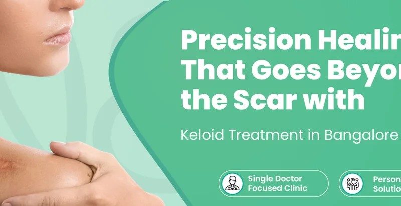 Keloid Laser Treatment: An Effective Way to Improve Raised Scars