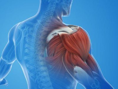 Shoulder Impingement in Gurgaon | Expert Physiotherapy for Lasting Shoulder Pain Relief